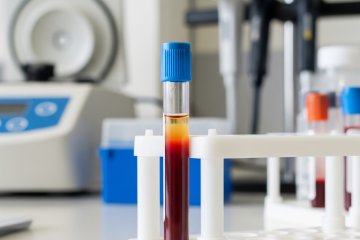 Fibrinogênio: O que é, causas e níveis ideais 2 Fibrinogenio hemolab